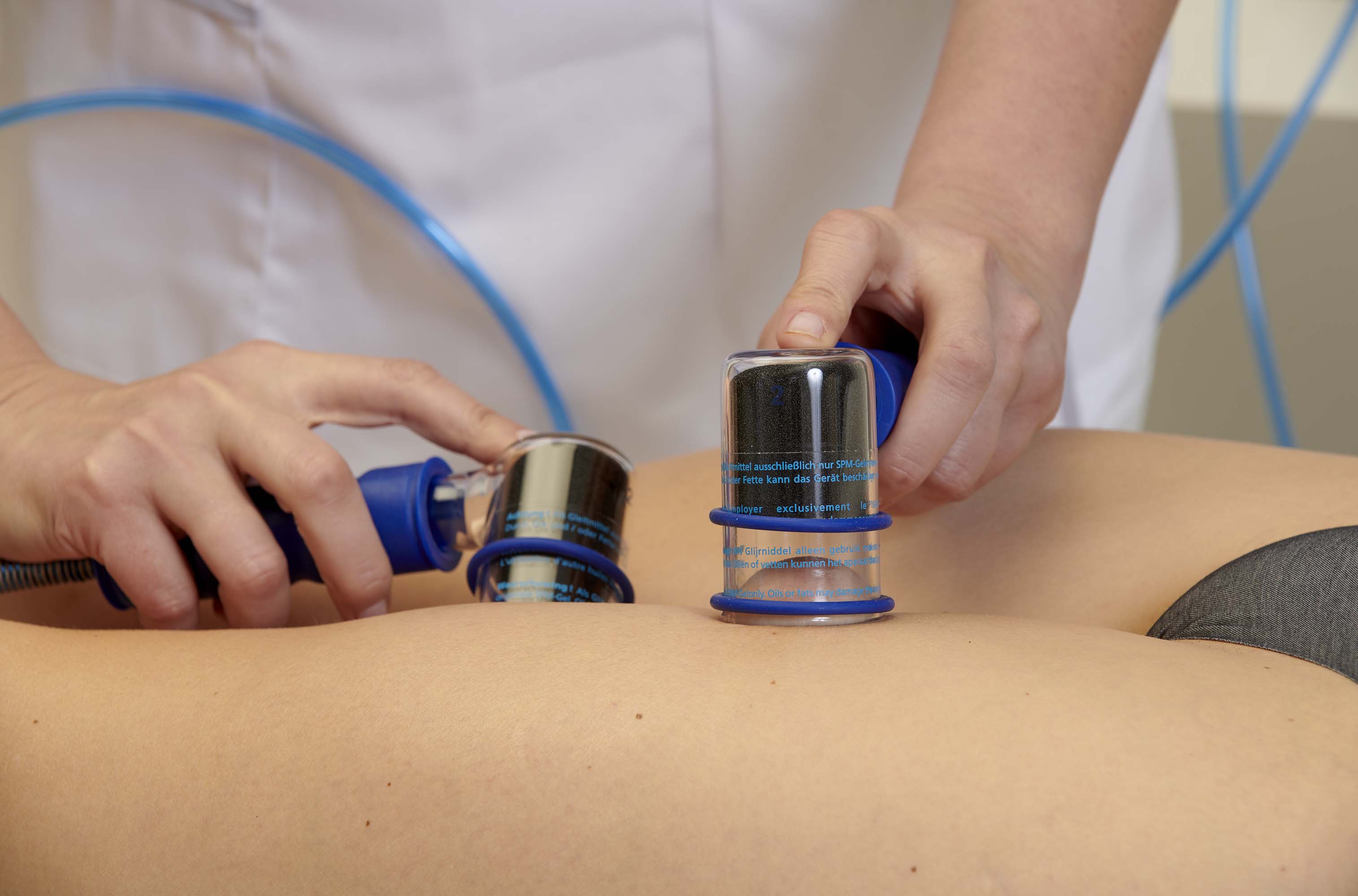 SPM – Gewebestimulation